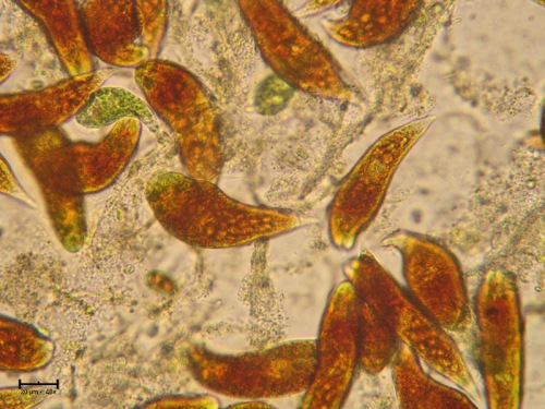 A fraction of a population of red euglenes under the microscope. Photo extracted from naturamediterraneo.com/forum/, posted by user Carlmor.